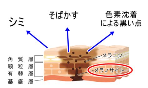 ちくび黒い|乳首に黒い点（ブツブツ）発見！原因とケア方法 